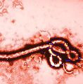1. Геморрагическая лихорадка Эбола.jpg